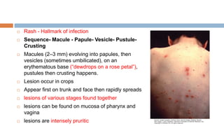 fever with rashfullfinal.pptx sms medical college | PPTX