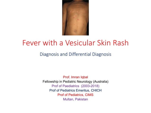 Fever with vesicular skin rash in children 2021 | PDF | Infectious ...