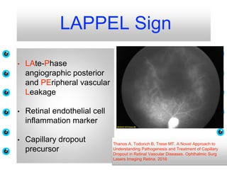 FEVR-familial exudative vitreoretinopathy.pptx