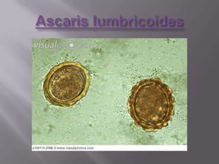 Few parasite eggs