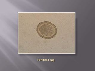 Few parasite eggs