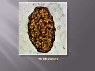 Few parasite eggs