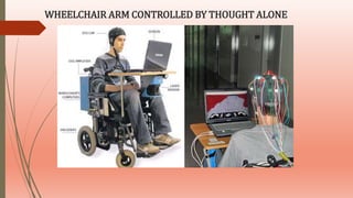 WHEELCHAIR ARM CONTROLLED BY THOUGHT ALONE
 
