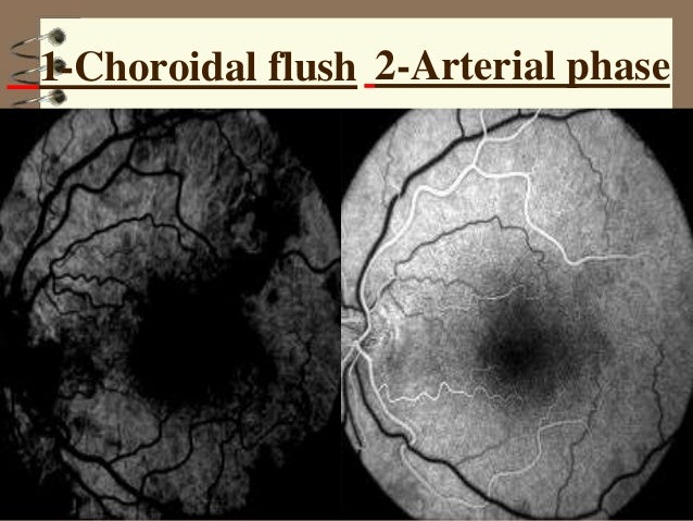 Red Free Fundus Photos Normal Appearance Autofluorescence Red Free Fundus Photos Normal Appearance Autofluorescence