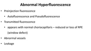 Fundus Fluorescence Angiography | PPTX