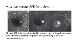 ffa Ophthalmology presentation on flurencence angiography.pptx