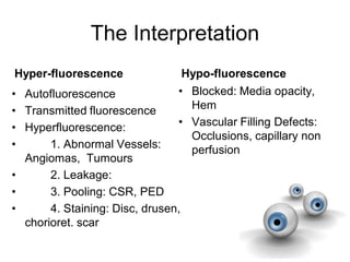 The Interpretation
Hypo-fluorescenceHyper-fluorescence
• Blocked: Media opacity,
Hem
• Vascular Filling Defects:
Occlusions, capillary non
perfusion
• Autofluorescence
• Transmitted fluorescence
• Hyperfluorescence:
• 1. Abnormal Vessels:
Angiomas, Tumours
• 2. Leakage:
• 3. Pooling: CSR, PED
• 4. Staining: Disc, drusen,
chorioret. scar
 