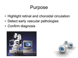 Purpose
• Highlight retinal and choroidal circulation
• Detect early vascular pathologies
• Confirm diagnosis
 