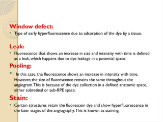 Fundus fluorescence angiography in retina | PPTX