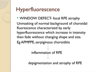 Fundus fluorescence angiography in retina | PPTX