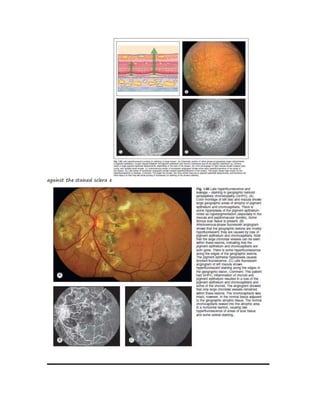 against the stained sclera e
 