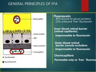 GENERAL PRINICIPLES OF FFA
Fluorescein
• 85% bound to serum proteins
• 15% unbound ‘free’ fluorescein
• Impermeable to fluorescein
Outer blood-retinal
barrier (zonula occludens)
• Impermeable to fluorescein
Choriocapillaris
Permeable only to ‘free’ fluoresce
Inner blood-retinal barrier
(retinal capillaries)
 