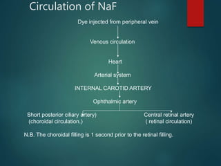 Circulation of NaF
Dye injected from peripheral vein
Venous circulation
Heart
Arterial system
INTERNAL CAROTID ARTERY
Ophthalmic artery
Short posterior ciliary artery) Central retinal artery
(choroidal circulation.) ( retinal circulation)
N.B. The choroidal filling is 1 second prior to the retinal filling.
 