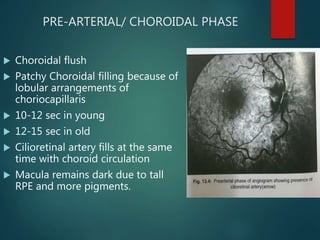 PRE-ARTERIAL/ CHOROIDAL PHASE
 Choroidal flush
 Patchy Choroidal filling because of
lobular arrangements of
choriocapillaris
 10-12 sec in young
 12-15 sec in old
 Cilioretinal artery fills at the same
time with choroid circulation
 Macula remains dark due to tall
RPE and more pigments.
 