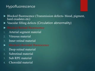 Hypofluorescence
 Blocked fluorescence (Transmission defects- blood, pigment,
hard exudates etc)
 Vascular filling defects (Circulation abnormality)
 Blocked Retinal fluorescence
1. Arterial segment material
2. Vitreous material
3. Inner retinal material
 Blocked choroidal fluorescence
1. Deep retinal material
2. Subretinal material
3. Sub RPE material
4. Choroidal material
 