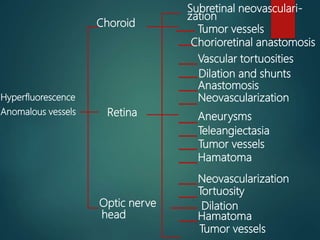 Hyperfluorescence
Anomalous vessels
Choroid
Retina
Optic nerve
head
Subretinal neovasculari-
zation
Tumor vessels
Chorioretinal anastomosis
Vascular tortuosities
Dilation and shunts
Anastomosis
Neovascularization
Aneurysms
Teleangiectasia
Tumor vessels
Hamatoma
Neovascularization
Tortuosity
Dilation
Hamatoma
Tumor vessels
 