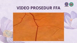Comprehensive Guide to Fundus Fluorescein Angiography (FFA) in Ocular ...