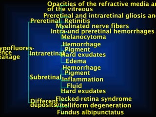 Opacities of the refractive media an
of the vitreous
Preretinal and intraretinal gliosis and
Preretinal Retinitis
Myelinated nerve fibers
Intra-und preretinal hemorrhages
Melanocytoma
Hemorrhage
ypofluoresPigment
ence
Intraretinal
Hard exudates
eakage
Edema
Hemorrhage
Pigment
Subretinal Inflammation
Fluid
Hard exudates
Flecked-retina syndrome
Different
deposits
Vitelliform degeneration
Fundus albipunctatus

 