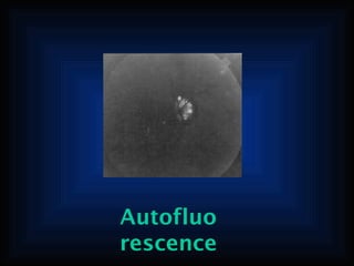 Autofluo
rescence

 
