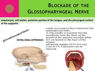 BLOCKADE OF THE
GLOSSOPHARYNGEAL NERVE
oropharynx, soft palate, posterior portion of the tongue, and the pharyngeal surface
of the epiglottis
INTRA-ORAL APPROACH
 