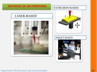 METHODS OF BIO PRINTIING
LASER-BASED
EXTRUSION BASED
INKJET BASED
Department Of Electronics and communication 13
 
