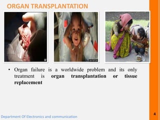 • Organ failure is a worldwide problem and its only
treatment is organ transplantation or tissue
replacement
ORGAN TRANSPLANTATION
Department Of Electronics and communication
4
 