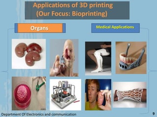 Applications of 3D printing
(Our Focus: Bioprinting)
Organs Medical Applications
Department Of Electronics and communication 9
 