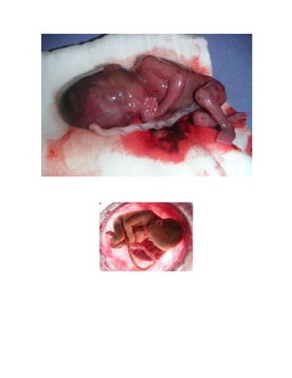 Fffffffffffffffffffffffffffffffffffffffffffffffffff