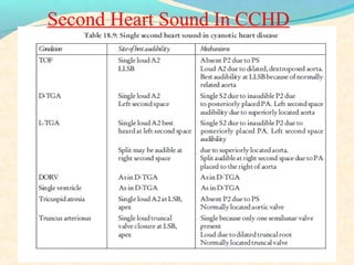 Second Heart Sound In CCHD
 