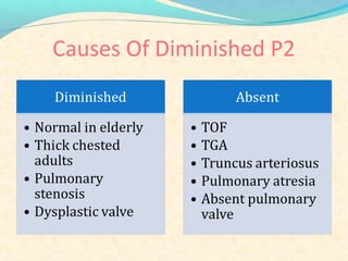 Causes Of Diminished P2
 