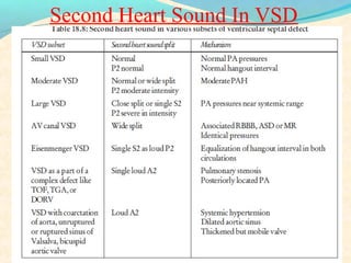 Second Heart Sound In VSD
 