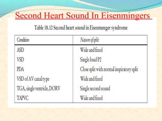 Second Heart Sound In Eisenmingers
 