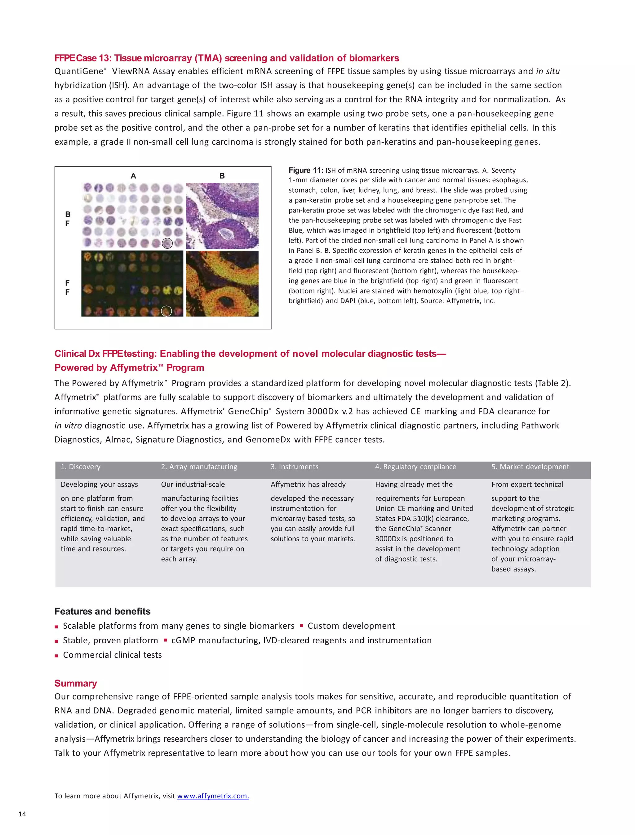 To learn more about Affymetrix, visit www.affymetrix.com.
14
FFPECase 13: Tissue microarray (TMA) screening and validation of biomarkers
QuantiGene® ViewRNA Assay enables efficient mRNA screening of FFPE tissue samples by using tissue microarrays and in situ
hybridization (ISH). An advantage of the two-color ISH assay is that housekeeping gene(s) can be included in the same section
as a positive control for target gene(s) of interest while also serving as a control for the RNA integrity and for normalization. As
a result, this saves precious clinical sample. Figure 11 shows an example using two probe sets, one a pan-housekeeping gene
probe set as the positive control, and the other a pan-probe set for a number of keratins that identifies epithelial cells. In this
example, a grade II non-small cell lung carcinoma is strongly stained for both pan-keratins and pan-housekeeping genes.
Clinical Dx FFPEtesting: Enabling the development of novel molecular diagnostic tests—
Powered by Affymetrix™ Program
The Powered by Affymetrix™ Program provides a standardized platform for developing novel molecular diagnostic tests (Table 2).
Affymetrix® platforms are fully scalable to support discovery of biomarkers and ultimately the development and validation of
informative genetic signatures. Affymetrix’ GeneChip® System 3000Dx v.2 has achieved CE marking and FDA clearance for
in vitro diagnostic use. Affymetrix has a growing list of Powered by Affymetrix clinical diagnostic partners, including Pathwork
Diagnostics, Almac, Signature Diagnostics, and GenomeDx with FFPE cancer tests.
Features and benefits
 Scalable platforms from many genes to single biomarkers  Custom development
 Stable, proven platform  cGMP manufacturing, IVD-cleared reagents and instrumentation
 Commercial clinical tests
Summary
Our comprehensive range of FFPE-oriented sample analysis tools makes for sensitive, accurate, and reproducible quantitation of
RNA and DNA. Degraded genomic material, limited sample amounts, and PCR inhibitors are no longer barriers to discovery,
validation, or clinical application. Offering a range of solutions—from single-cell, single-molecule resolution to whole-genome
analysis—Affymetrix brings researchers closer to understanding the biology of cancer and increasing the power of their experiments.
Talk to your Affymetrix representative to learn more about how you can use our tools for your own FFPE samples.
Figure 11: ISH of mRNA screening using tissue microarrays. A. Seventy
1-mm diameter cores per slide with cancer and normal tissues: esophagus,
stomach, colon, liver, kidney, lung, and breast. The slide was probed using
a pan-keratin probe set and a housekeeping gene pan-probe set. The
pan-keratin probe set was labeled with the chromogenic dye Fast Red, and
the pan-housekeeping probe set was labeled with chromogenic dye Fast
Blue, which was imaged in brightfield (top left) and fluorescent (bottom
left). Part of the circled non-small cell lung carcinoma in Panel A is shown
in Panel B. B. Specific expression of keratin genes in the epithelial cells of
a grade II non-small cell lung carcinoma are stained both red in bright-
field (top right) and fluorescent (bottom right), whereas the housekeep-
ing genes are blue in the brightfield (top right) and green in fluorescent
(bottom right). Nuclei are stained with hemotoxylin (light blue, top right−
brightfield) and DAPI (blue, bottom left). Source: Affymetrix, Inc.
A
B
F
F
F
B
1. Discovery 2. Array manufacturing 3. Instruments 4. Regulatory compliance 5. Market development
Developing your assays Our industrial-scale Affymetrix has already Having already met the From expert technical
on one platform from manufacturing facilities developed the necessary requirements for European support to the
start to finish can ensure offer you the flexibility instrumentation for Union CE marking and United development of strategic
efficiency, validation, and to develop arrays to your microarray-based tests, so States FDA 510(k) clearance, marketing programs,
rapid time-to-market, exact specifications, such you can easily provide full the GeneChip® Scanner Affymetrix can partner
while saving valuable as the number of features solutions to your markets. 3000Dx is positioned to with you to ensure rapid
time and resources. or targets you require on assist in the development technology adoption
each array. of diagnostic tests. of your microarray-
based assays.
 