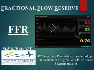 FRACTIONAL FLOW RESERVE
FFR
ROSALIE MANLY
4ème Rencontre Paramédicale en Cardiologie
Interventionnelle Région Paris-Île de France
15 Septembre 2018
 