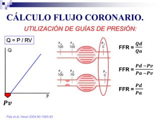 CÁLCULO FLUJO CORONARIO.
Pijls et al. Heart 2004;90:1085-93
UTILIZACIÓN DE GUÍAS DE PRESIÓN:
Q = P / RV
 