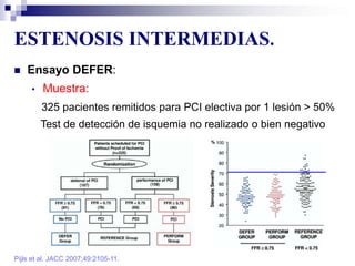 ESTENOSIS INTERMEDIAS.
Pijls et al. JACC 2007;49:2105-11.
 Ensayo DEFER:
• Muestra:
325 pacientes remitidos para PCI electiva por 1 lesión > 50%
Test de detección de isquemia no realizado o bien negativo
 