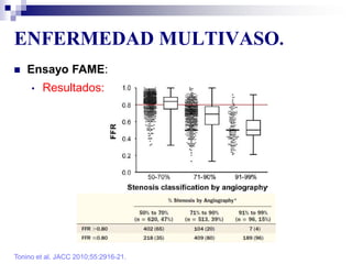 ENFERMEDAD MULTIVASO.
Tonino et al. JACC 2010;55:2916-21.
 Ensayo FAME:
• Resultados:
 