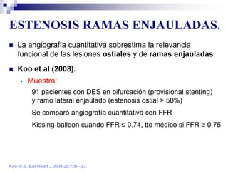 ESTENOSIS RAMAS ENJAULADAS.
Koo et al. Eur Heart J 2008;29:726 –32.
 La angiografía cuantitativa sobrestima la relevancia
funcional de las lesiones ostiales y de ramas enjauladas
 Koo et al (2008).
• Muestra:
91 pacientes con DES en bifurcación (provisional stenting)
y ramo lateral enjaulado (estenosis ostial > 50%)
Se comparó angiografía cuantitativa con FFR
Kissing-balloon cuando FFR ≤ 0.74, tto médico si FFR ≥ 0.75
 