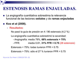 ESTENOSIS RAMAS ENJAULADAS.
Koo et al. Eur Heart J 2008;29:726 –32.
 La angiografía cuantitativa sobrestima la relevancia
funcional de las lesiones ostiales y de ramas enjauladas
 Koo et al (2008).
• Resultados:
No pasó la guía de presión en 4 / 96 estenosis (4.2 %)
La angiografía cuantitativa sobrestimó la severidad:
- Angiografía: media 79%, 68% estenosis > 75%
- FFR: media 0.81, 31% FFR < 0.75 (28 estenosis)
Estenosis < 75%: todas tuvieron FFR > 0.75
Estenosis > 75%: sólo el 27 % tuvieron FFR < 0.75
 
