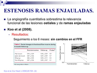 ESTENOSIS RAMAS ENJAULADAS.
Koo et al. Eur Heart J 2008;29:726 –32.
 La angiografía cuantitativa sobrestima la relevancia
funcional de las lesiones ostiales y de ramas enjauladas
 Koo et al (2008).
• Resultados:
Seguimiento a los 6 meses: sin cambios en el FFR
 