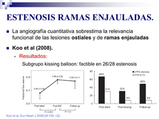 ESTENOSIS RAMAS ENJAULADAS.
Koo et al. Eur Heart J 2008;29:726 –32.
 La angiografía cuantitativa sobrestima la relevancia
funcional de las lesiones ostiales y de ramas enjauladas
 Koo et al (2008).
• Resultados:
Subgrupo kissing balloon: factible en 26/28 estenosis
 
