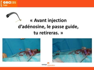 « Avant injection
d’adénosine, le passe guide,
tu retireras. »
 