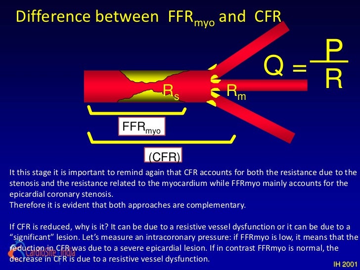 Value of FFR in clinical practice