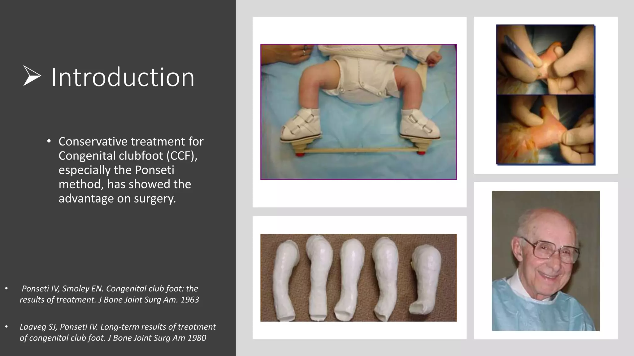 French Functional Method for Congenital Clubfoot: 20 years of ...