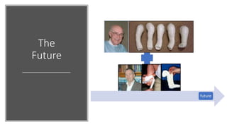 French Functional Method for Congenital Clubfoot: 20 years of ...