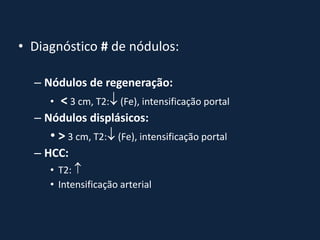 • Diagnóstico # de nódulos:

  – Nódulos de regeneração:
     •   < 3 cm, T2: (Fe), intensificação portal
  – Nódulos displásicos:
     • > 3 cm, T2: (Fe), intensificação portal
  – HCC:
     • T2: 
     • Intensificação arterial
 