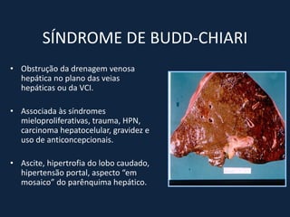 SÍNDROME DE BUDD-CHIARI
• Obstrução da drenagem venosa
  hepática no plano das veias
  hepáticas ou da VCI.

• Associada às síndromes
  mieloproliferativas, trauma, HPN,
  carcinoma hepatocelular, gravidez e
  uso de anticoncepcionais.

• Ascite, hipertrofia do lobo caudado,
  hipertensão portal, aspecto “em
  mosaico” do parênquima hepático.
 