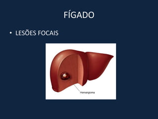 FÍGADO
• LESÕES FOCAIS
 