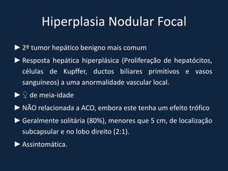 Hiperplasia Nodular Focal
► 2º tumor hepático benigno mais comum
► Resposta hepática hiperplásica (Proliferação de hepatócitos,
  células de Kupffer, ductos biliares primitivos e vasos
  sanguíneos) a uma anormalidade vascular local.
► ♀ de meia-idade
► NÃO relacionada a ACO, embora este tenha um efeito trófico
► Geralmente solitária (80%), menores que 5 cm, de localização
  subcapsular e no lobo direito (2:1).
► Assintomática.
 