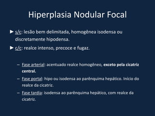 Hiperplasia Nodular Focal
► s/c: lesão bem delimitada, homogênea isodensa ou
  discretamente hipodensa.
► c/c: realce intenso, precoce e fugaz.


   – Fase arterial: acentuado realce homogêneo, exceto pela cicatriz
     central.
   – Fase portal: hipo ou isodensa ao parênquima hepático. Início do
     realce da cicatriz.
   – Fase tardia: isodensa ao parênquima hepático, com realce da
     cicatriz.
 